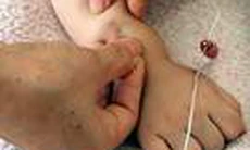 Châm cứu điều trị hiệu quả bệnh não ở trẻ em